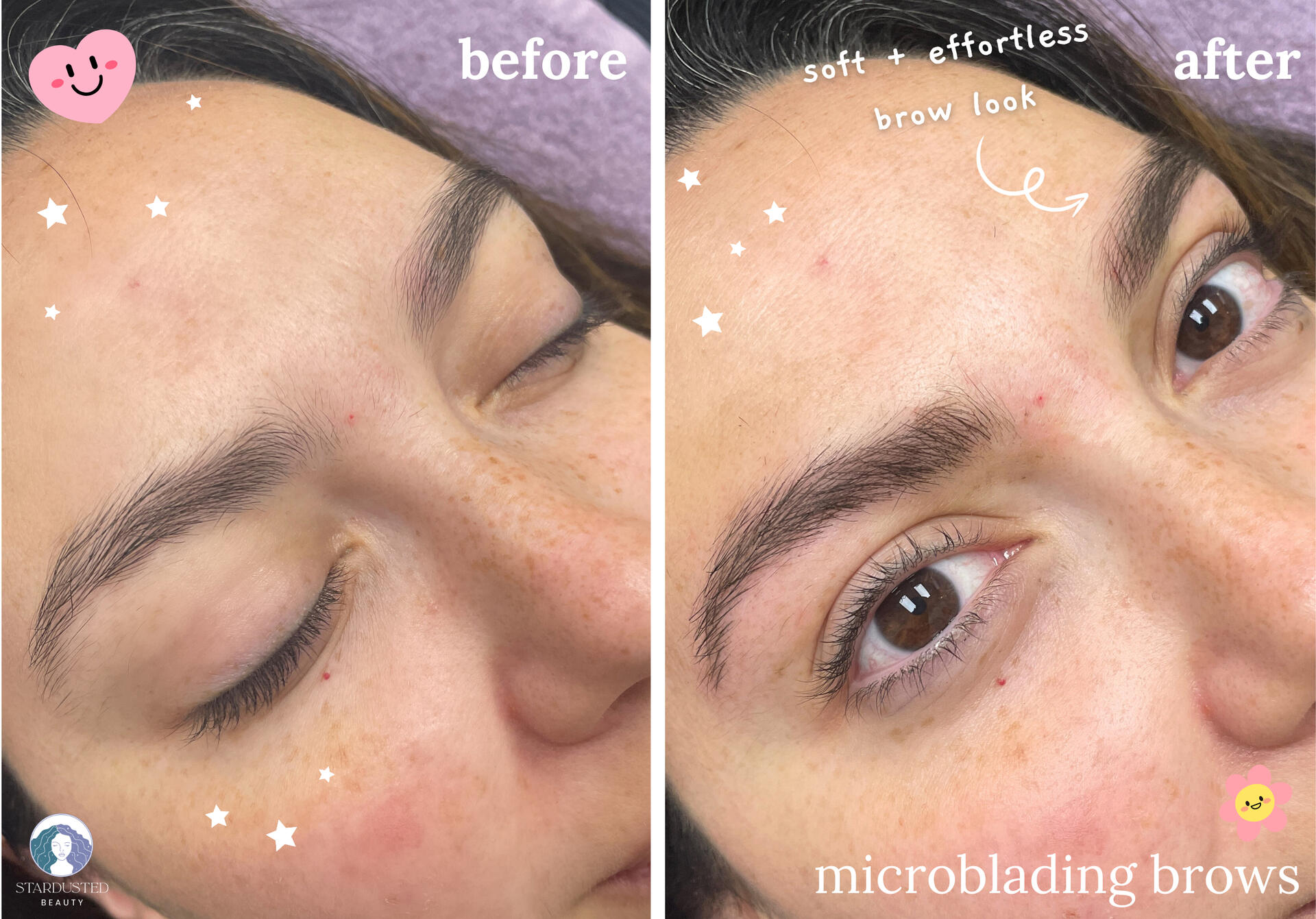 before and after microblading result with a natural brown color and a fluffy, feathery look