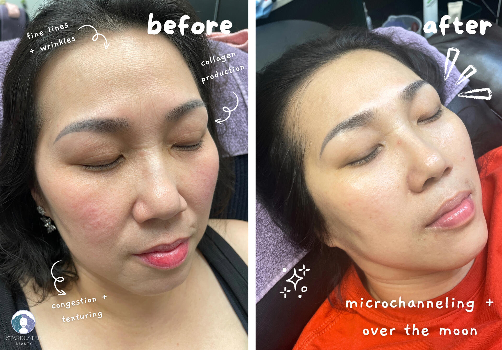 natural eyebrow microblading, close up of brow strokes