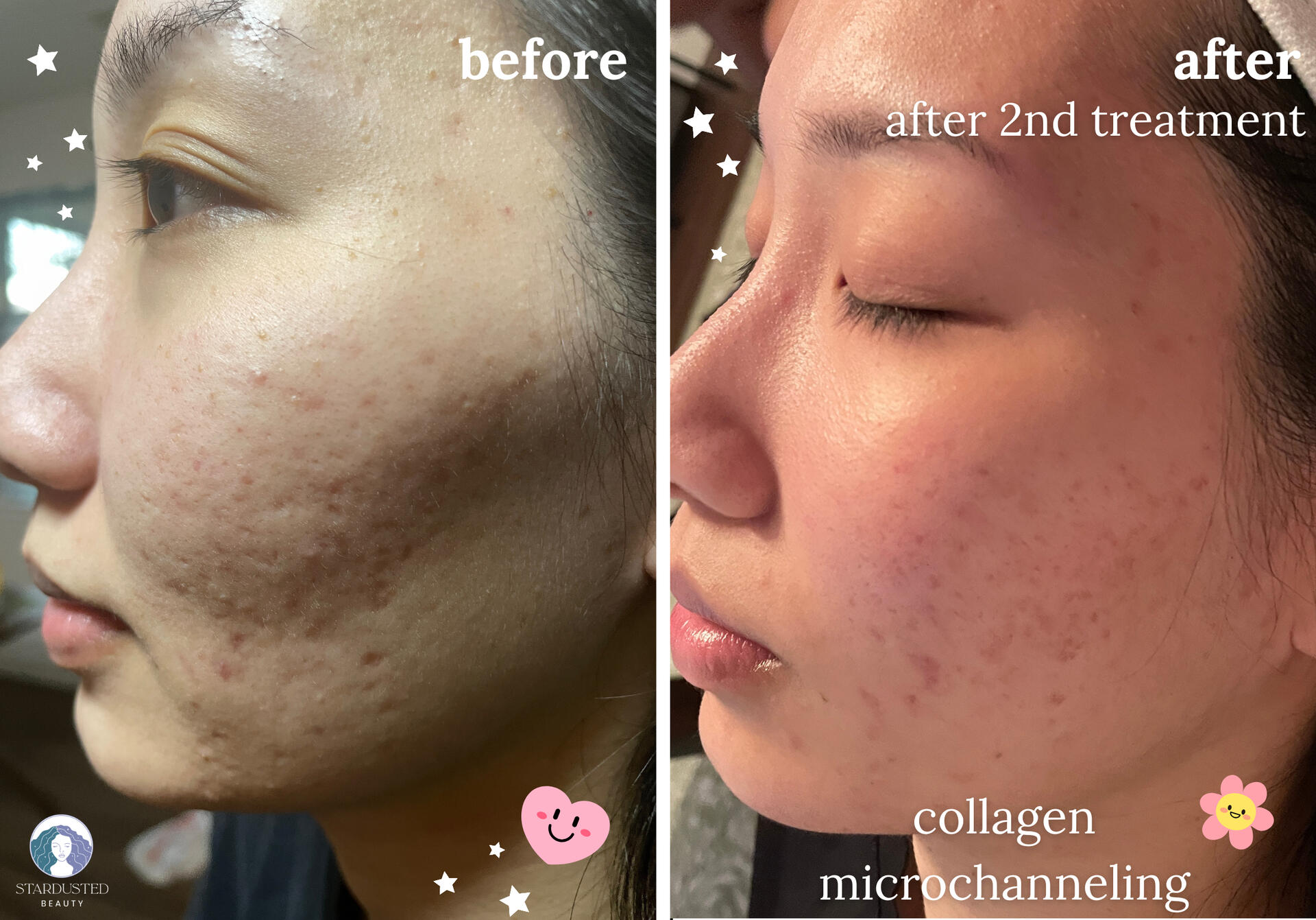 men's microblading before and after, natural pmu brow results